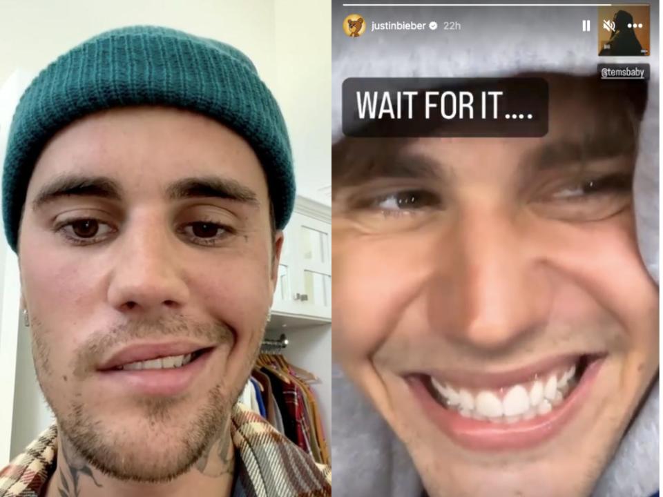 left: justin bieber in june 2022 wearing a green beanie, smiling with only half of his face while the other half remains neutral; right: justin bieber on his instagram story in march 2023, grinning widely with his entire face. there's an on screen caption that reads "wait for it..." and a small icon showing the yellow album art for singer tems' song "ice t"