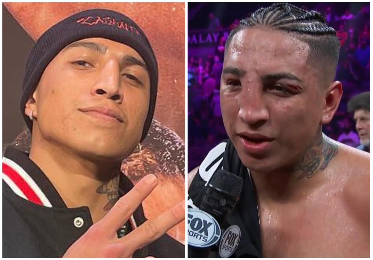 El boxeador estadounidense de origen mexicano Mario Barrios antes y después de su pelea con Keith Thurman. (Foto: Instagram / @boxer_barrios / Fox Sports).