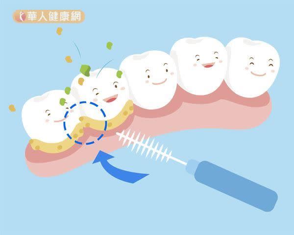 （情境照片／華人健康網圖庫提供）