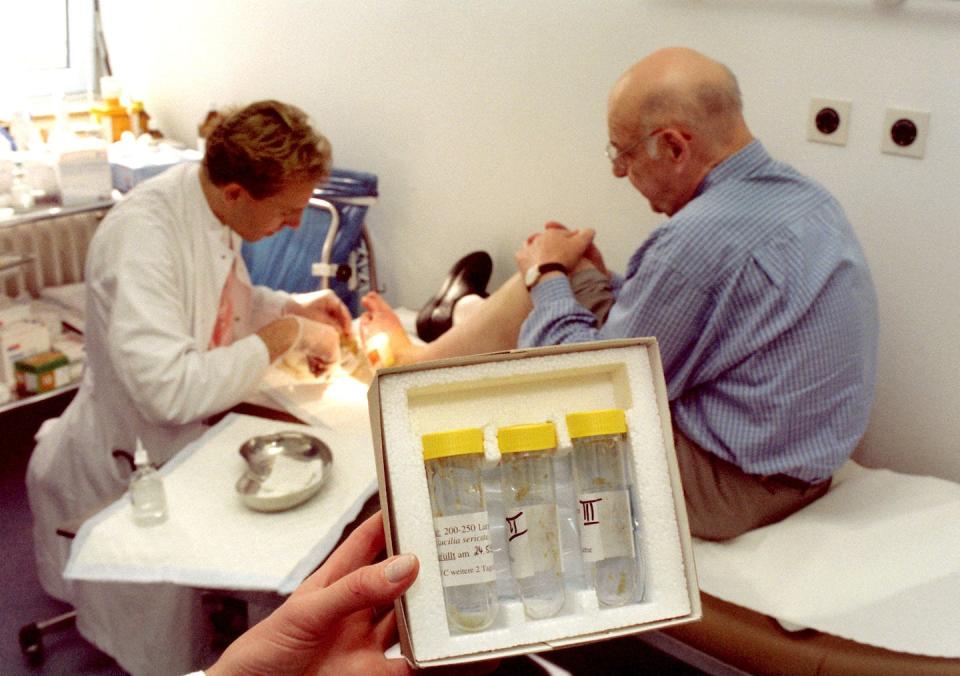 A doctor uses sterile maggots like those in these tubes to clean a patient’s foot wound. <a href="https://www.gettyimages.com/detail/news-photo/steril-gezüchtete-maden-im-vordergrund-in-reagenzgläsern-zu-news-photo/1213178783" rel="nofollow noopener" target="_blank" data-ylk="slk:Norbert Försterling/picture alliance via Getty Images;elm:context_link;itc:0;sec:content-canvas" class="link ">Norbert Försterling/picture alliance via Getty Images</a>