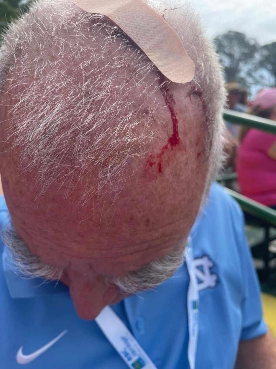 Mike Norman sports a large bandage on his head after he was hit by a golf ball at the RBC Heritage golf tournament on April 19 in Hilton Head, South Carolina.