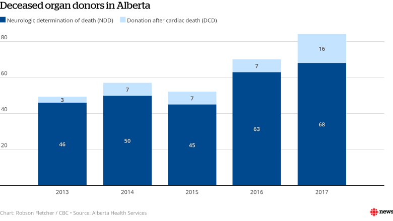 How dropping the 'brain death' requirement has boosted organ donations in Alberta