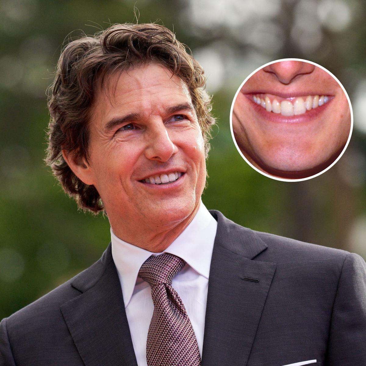 tom cruise smile off center