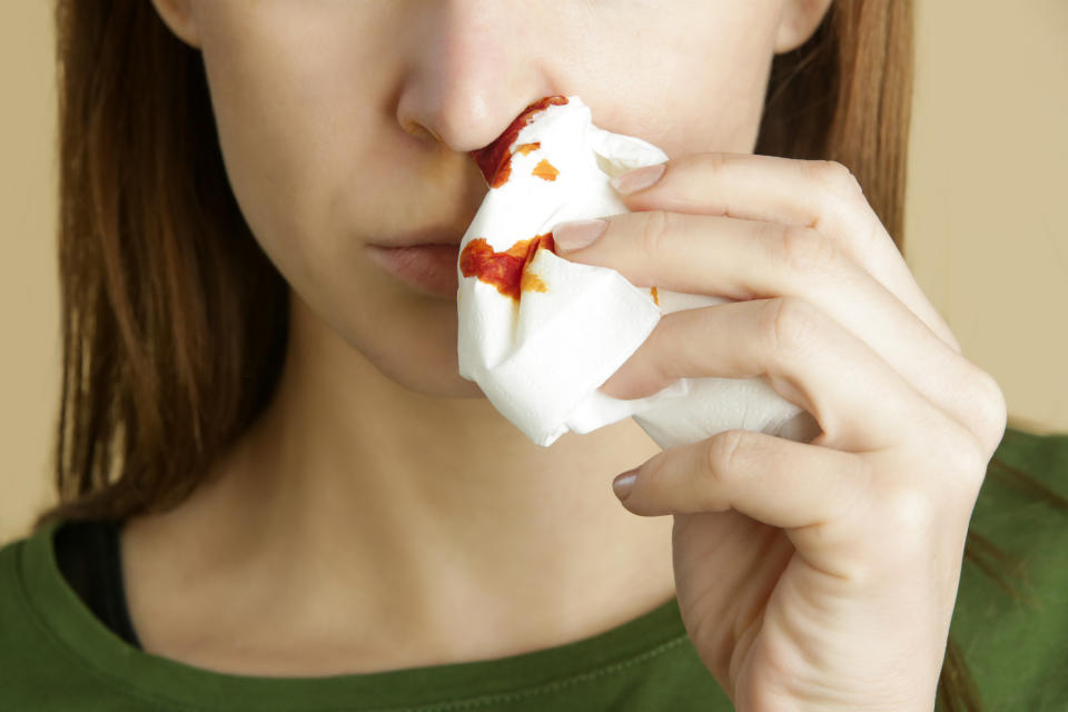 Normalmente, la mayoría de las hemorragias nasales suelen detenerse sin que se necesite ayuda médica en un periodo de tiempo comprendido entre quince y veinte minutos. (Foto: Getty)
