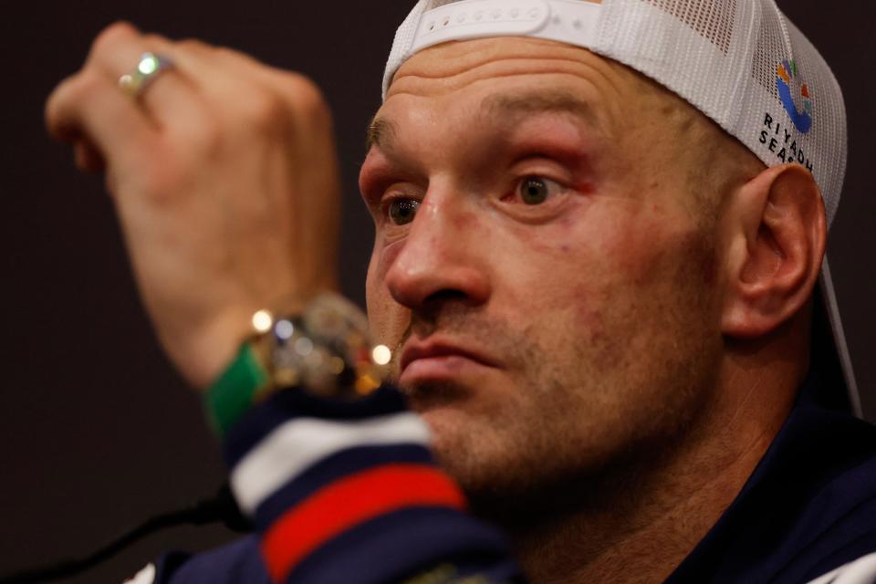 Tyson Fury during his post-fight press conference (Action Images via Reuters)