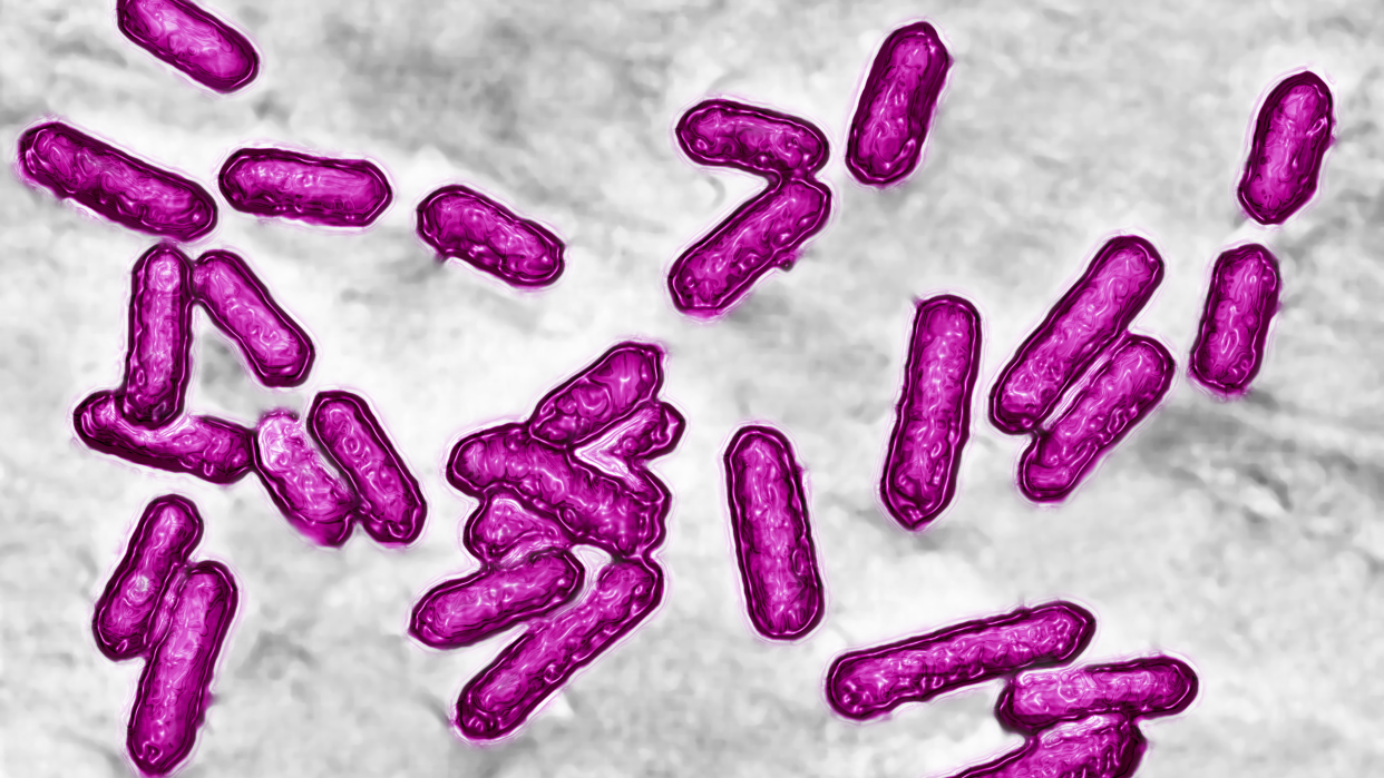 Listeria seen microscopically