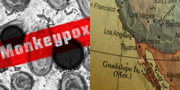 ¿Se acerca viruela del mono a Tijuana? Investigan posible caso en Los Ángeles