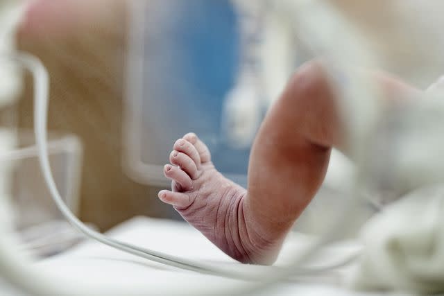 <p>Getty Images</p> A premature baby.