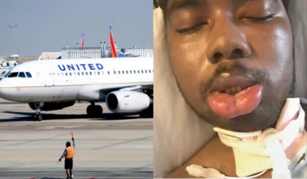 Un agente de United Airlines supuestamente empujó a un hombre tetrapléjico fuera del avión y «agresivamente» y luego «se rió».  Ahora la empresa le debe a su familia 30 millones de dólares