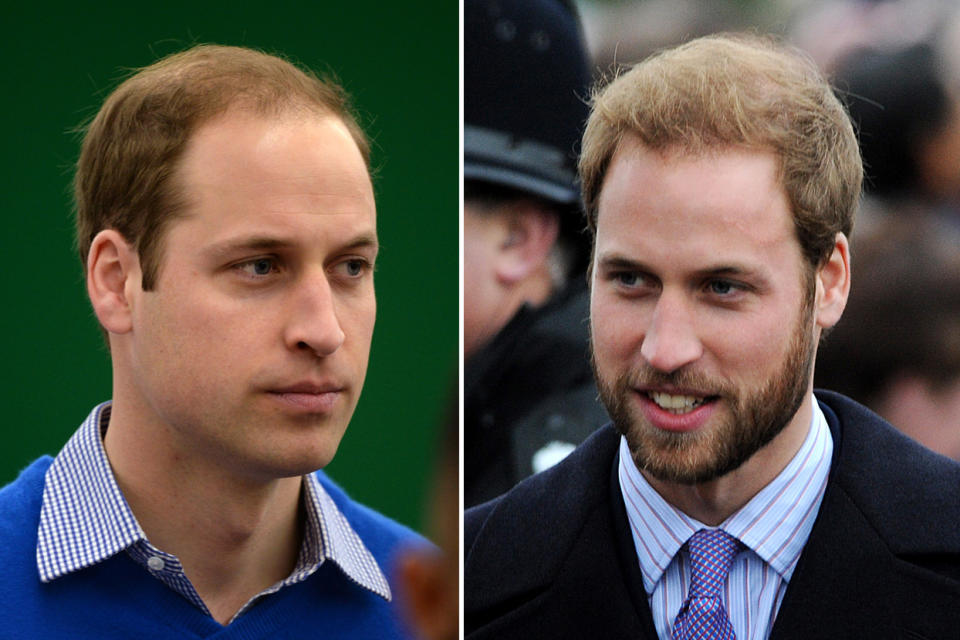 Nachdem die Haare von Prinz William auf dem Kopf immer weniger wurden, überlegte er sich: Dann lass ich mir einfach einen Vollbart wachsen – das kaschiert. Seiner Frau Kate schien der Bart nicht so gut gefallen zu haben, mittlerweile trägt William wieder glattrasiert.