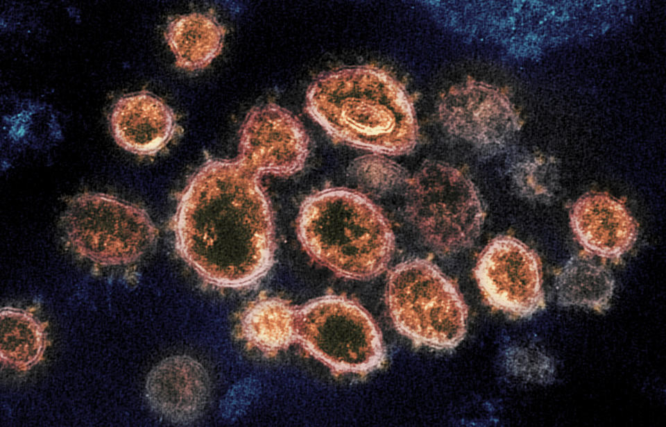 This 2020 electron microscope image provided by the National Institute of Allergy and Infectious Diseases - Rocky Mountain Laboratories shows SARS-CoV-2 virus particles which causes COVID-19, isolated from a patient in the U.S., emerging from the surface of cells cultured in a lab. Coronaviruses, including the newest one, are named for the spikes that cover their outer surface like a crown, or corona in Latin. Using those club-shaped spikes, the virus latches on to the outer wall of a human cell, invades it and replicates, creating viruses to hijack more cells. (NIAID-RML via AP)