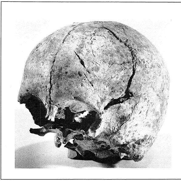A skull unearthed in the Alamo complex in March 1979 by archaeologists James Ivey and Anne Fox.