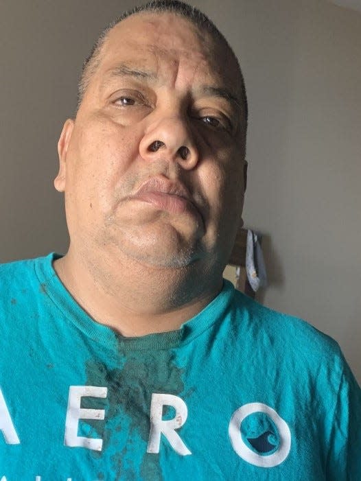 Roberto Placido Sandoval. The blood on his shirt is from his mouth, after he said a dentist pulled 13 of his teeth instead of just three.