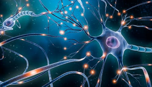 <span class="caption">Epileptic seizures are caused by brain cells becoming overactive. </span> <span class="attribution"><a class="link " href="https://www.shutterstock.com/image-illustration/neuronal-network-electrical-activity-neuron-cells-1691666992" rel="nofollow noopener" target="_blank" data-ylk="slk:MattLphotography/ Shutterstock;elm:context_link;itc:0;sec:content-canvas">MattLphotography/ Shutterstock</a></span>