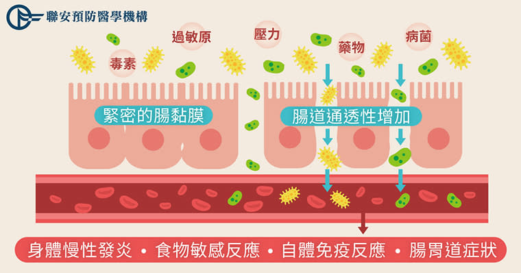 <strong>罹患腸漏症，腸道通透性增加，有害物質就容易滲透進血液中引起不適症狀。（圖／聯安預防醫學機構提供）</strong>