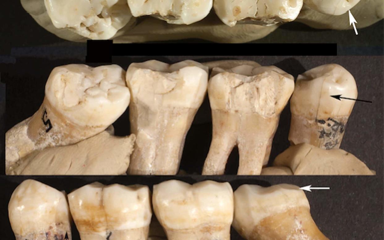 Neanderthal teeth - PA