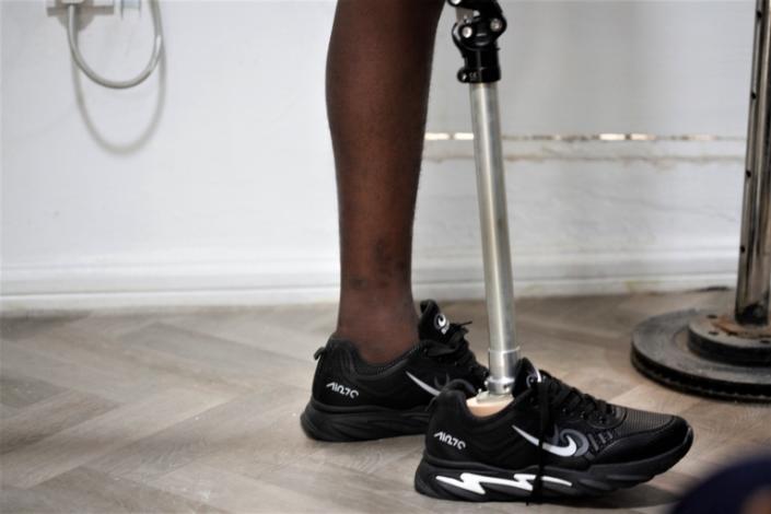 A prosthetic leg is affixed for a child at the Irede Prosthetic Centre in the Ogudu district, Lagos, Nigeria, 07 October 2022. The Irede Foundation is a non-governmental organisation focused on encouraging children ages 0-18, living with limb loss, either acquired or congenital, to live a life of fulfillment, and to inspire action so a child amputee can live independently through the provision of a prosthetic limb. Of the world&quot;s population, at least one billion people, have some form of disability, whether present at birth or acquired later in life. Nearly 240 million of them are children, according to UNICEF.