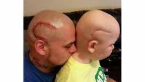 <p>Luego de que su hijo Gabriel tuviera que someterse a una cirugía para extraerle un tumor cerebral maligno, cuya secuela fue una cicatriz en el lado derecho de su cabeza, Josh Marshall, originario de Kansas, en Estados Unidos, decidió tatuarse una marca similar a la del menor de 8 años de edad. La imagen difundida en redes sociales muestra a hijo y padre con la misma línea roja en el cráneo. La decisión de Josh buscaba que Gabriel aumentara su confianza en sí mismo y no se sintiera diferente a los demás. Marshall ha quedado como uno de los padres del año de este 2016 alrededor del mundo. (Facebook) </p>