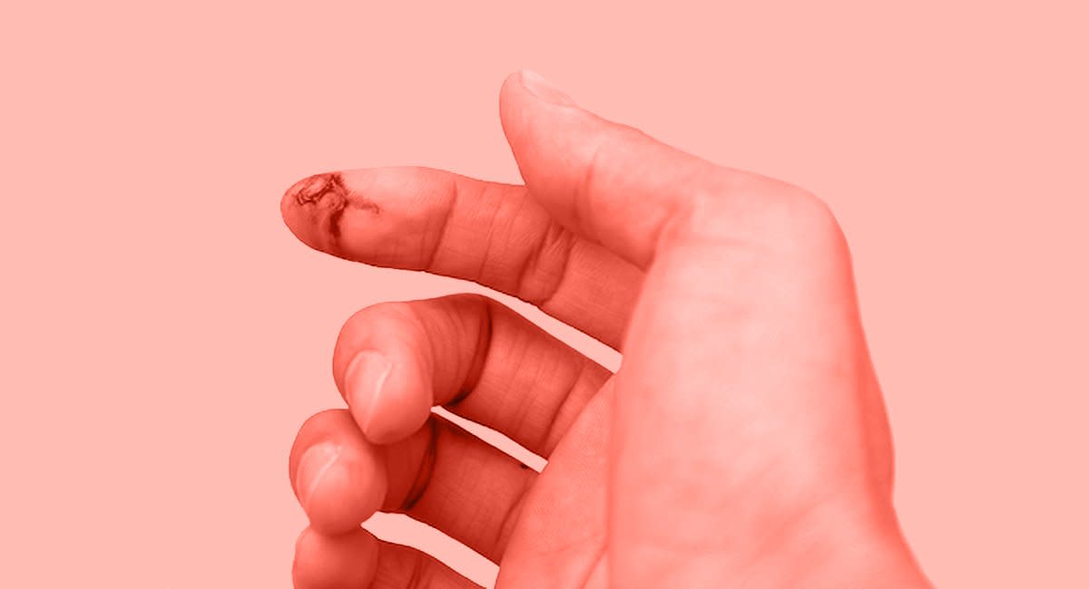 Why Are Paper Cuts So Painful?, Eden's Blog