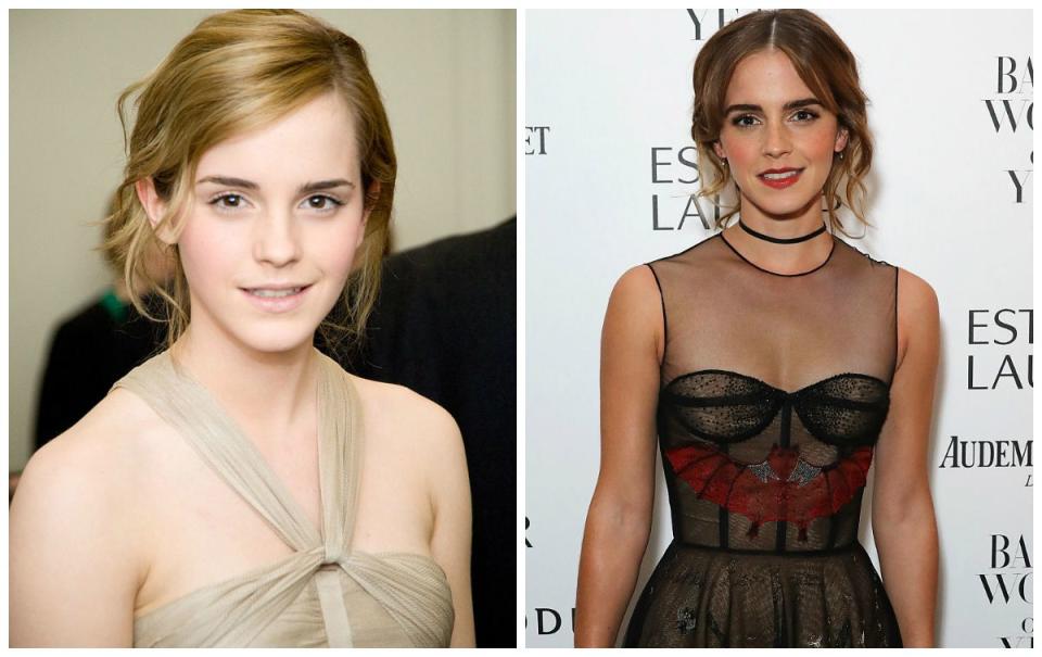 <p>Emma Watson était encore une adolescente sur la première photo. Depuis, l'actrice est devenue mannequin, icône de mode, et plus impressionnant encore, ambassadrice de bonne volonté de l'ONU auprès des femmes. (Photo : Getty) </p>