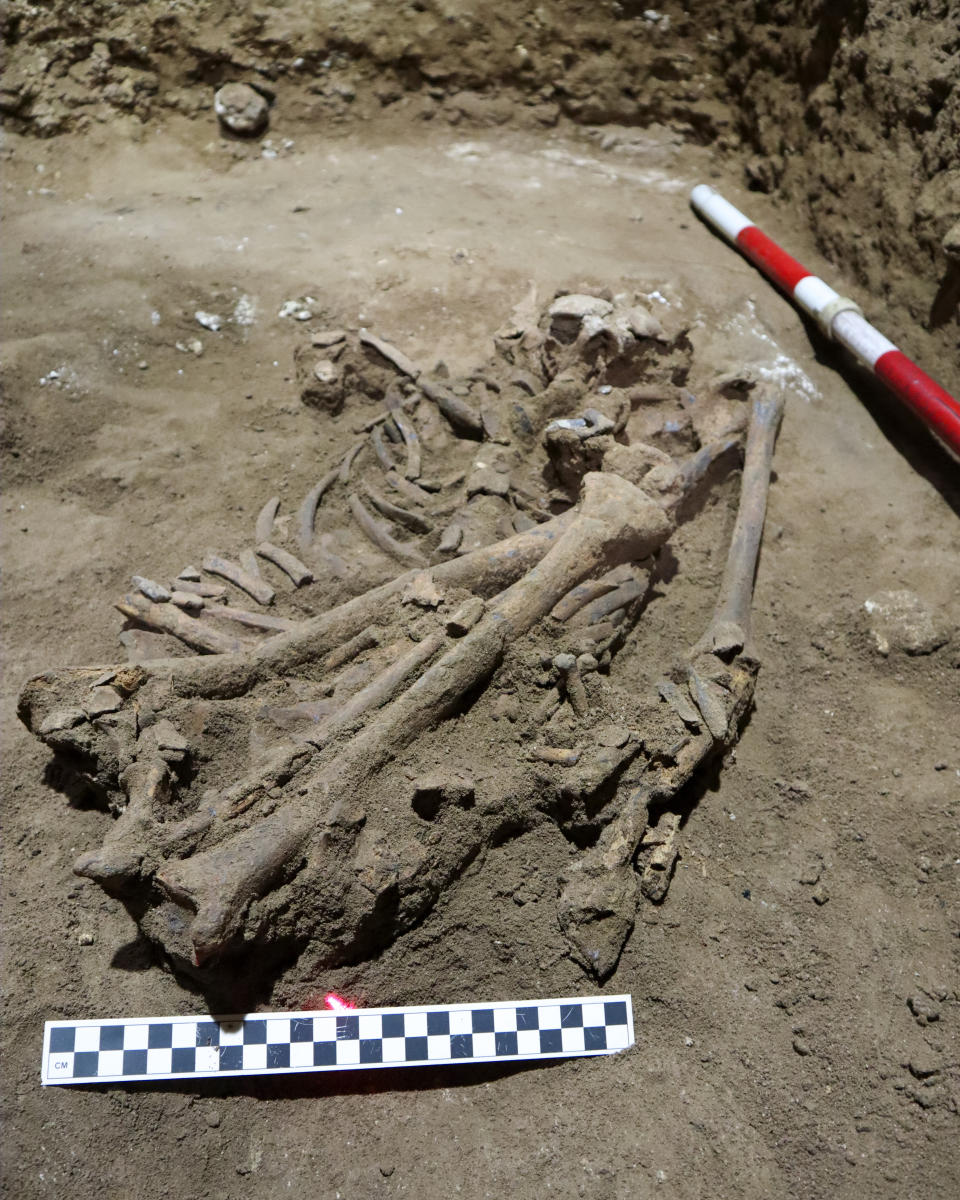 The human skeleton found in Borneo, dated to about 31,000 years ago, pictured in a cave in East Kalimantan, Borneo, Indonesia is photographed on March 4, 2020. The remains, which have been dated to 31,000 years old, mark the oldest evidence for amputation yet discovered. And the prehistoric “surgery” could show that humans were making medical advances much earlier than previously thought, according to the study published Wednesday, Sept. 7, 2022 in the journal Nature. (Photo Courtesy of Tim Maloney/Griffith University via AP)