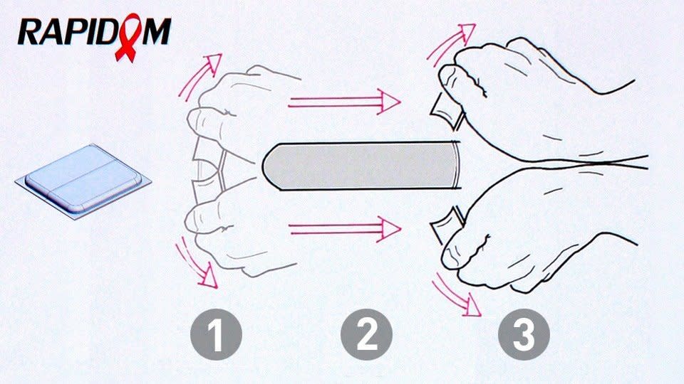 Willem van Rensburg of Kimbranox Ltd. in South Africa will test a condom applicator, the Rapidom, which is designed for easy, technique-free application of male condoms. Kimbranox will test an applicator designed to be applied with one motion, thereby minimizing interruption.