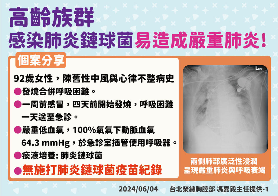 接種肺炎鏈球菌疫苗對中重症保護力可達75%，能有效降低感染後如肺炎、敗血症等及死亡機率。   圖：疾管署／提供