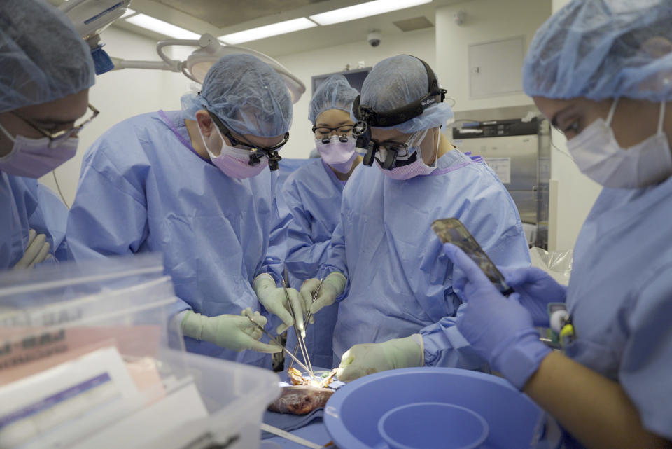 Surgeons remove a gene-edited transplanted pig kidney from the body of Maurice “Mo” Miller at NYU Langone Health in New York on Wednesday, Sept. 13, 2023. For a history-making 61 days and despite a brief rejection blip, a pig’s kidney worked normally inside his brain-dead body. (AP Photo/Shelby Lum)