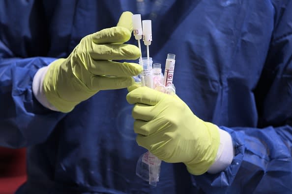 A doctor holds a coronavirus test.