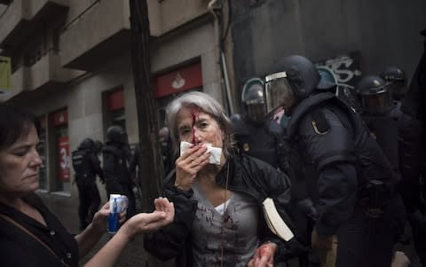 A woman tends to her injuries in front of riot police near a school being used as a polling station  - Credit: Geraldine Hope Ghelli/Bloomberg