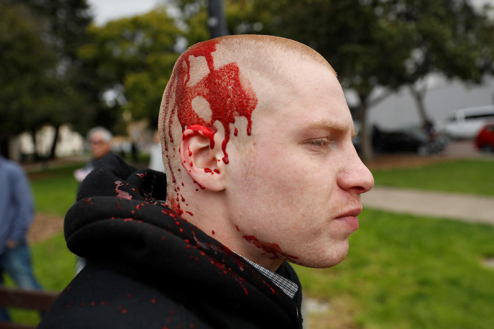 Pro-Trump rally turns violent in Berkeley