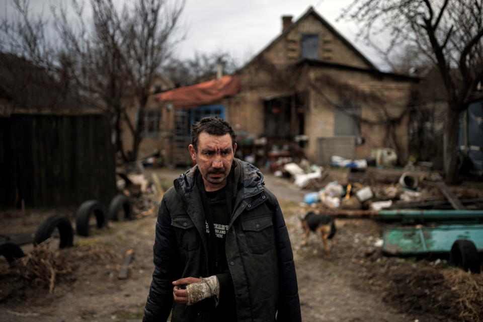 A man, who says Russian soldiers broke his arm, stands outside his house, amid Russia's invasion of Ukraine, in Bucha, in Kyiv region, Ukraine, April 6, 2022. REUTERS/Alkis Konstantinidis