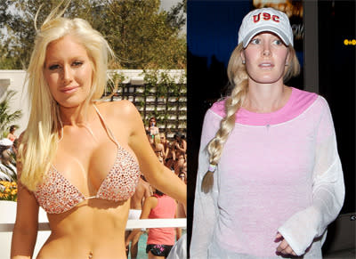 The family with £50,000 of breast implants and the sister who says