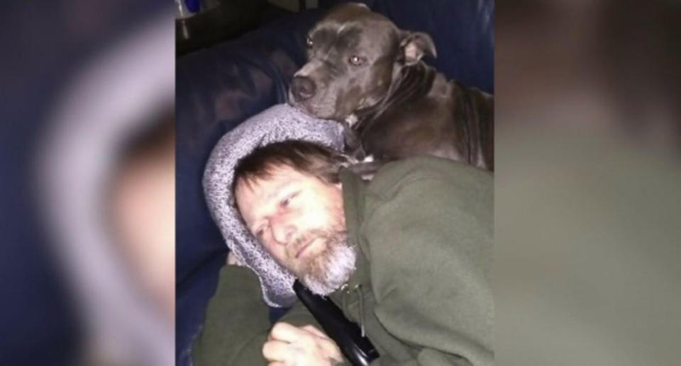 Wisconsin man has all four limbs amputated after dog lick