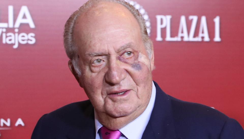 Don Juan Carlos y su llamativo hematoma junto al ojo izquierdo (GTres).