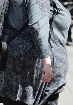 More years of obesity linked to higher risk of disease, study suggests