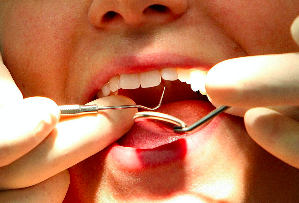 A man says he pulled out his own tooth after waiting almost two years for an NHS dentist (Picture: PA)