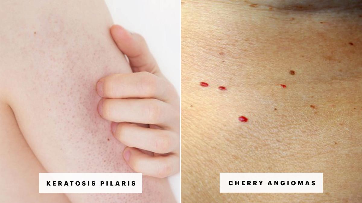 7-reasons-your-skin-has-red-spots-and-bumps