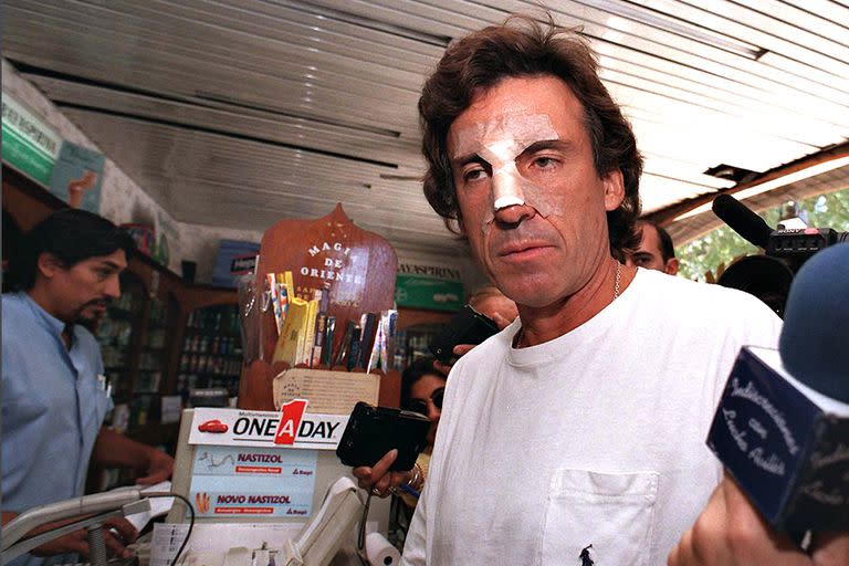 Huberto Roviralta en una farmacia porteña, luciendo las huellas de la pelea con la diva