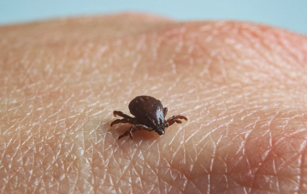 Different species of ticks can spread Rocky Mountain spotted fever  (Marijan Murat / picture alliance via Getty Images)