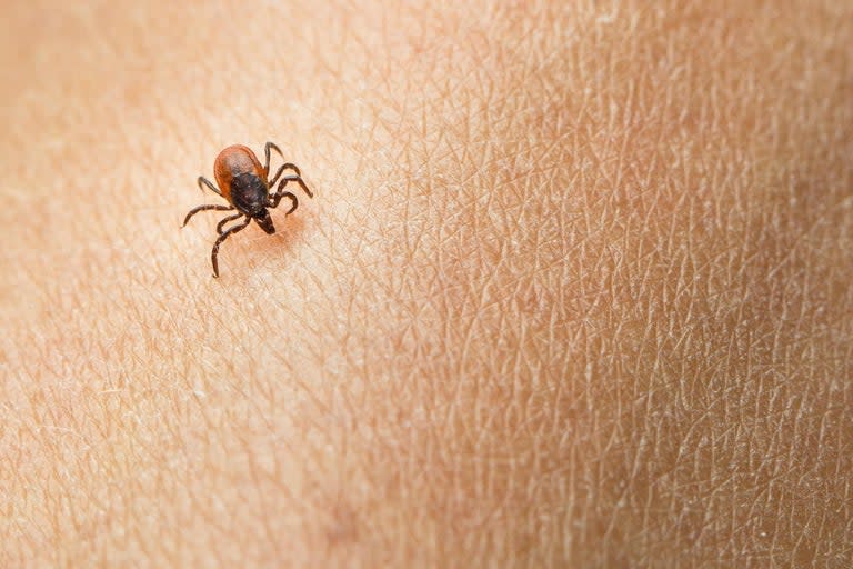 A man who went to the doctor for an irritated eye discovered that the cause of his discomfort was a tick. Chris Prater, an electrical worker from Kentucky, was working at a tree-cutting job in Johnson County when he felt something enter his eye. “The thing of it is, I really didn’t want to go to the doctor,” Prater told WYMT. “I figured if it was something it would come out on its own."Assuming the irritation was from sawdust, he flushed his eye but the discomfort continued - eventually prompting Prater to seek the help of an optometrist. According to Prater, the doctor was immediately able to identify the source of his eye irritation. “When the doctor finally comes in, he was looking at it. He said: ‘I know what’s in your eye.’" Prater recalled. “He said: ‘It’s a tick.’ That’s when I got scared a little bit. “I leaned around and looked at him and I asked him if he was joking and he said ‘No, you have a deer tick or some type of tick.’”To remove the tick, the doctor first numbed Prater’s eye and then used tweezers to pull the creature out. “Once he grabbed ahold of it and pulled it off, the tick made a little popping sound when it came off of my eye,” Prater said. According to Prater, who was sent home with antibiotics and steroid drops, he sprays himself with bug repellant everyday before work. He also urged kids who are hiking or camping to spray themselves - but acknowledged that you can’t “spray your eyes”.Fortunately, the situation is unlikely, according to Vivian Shibayama, OD, an optometrist with UCLA Health, who told Prevention it is “very uncommon” to find a tick on an eyeball.If a tick does manage to make it to the eye area, they are most likely to be found on the lid.