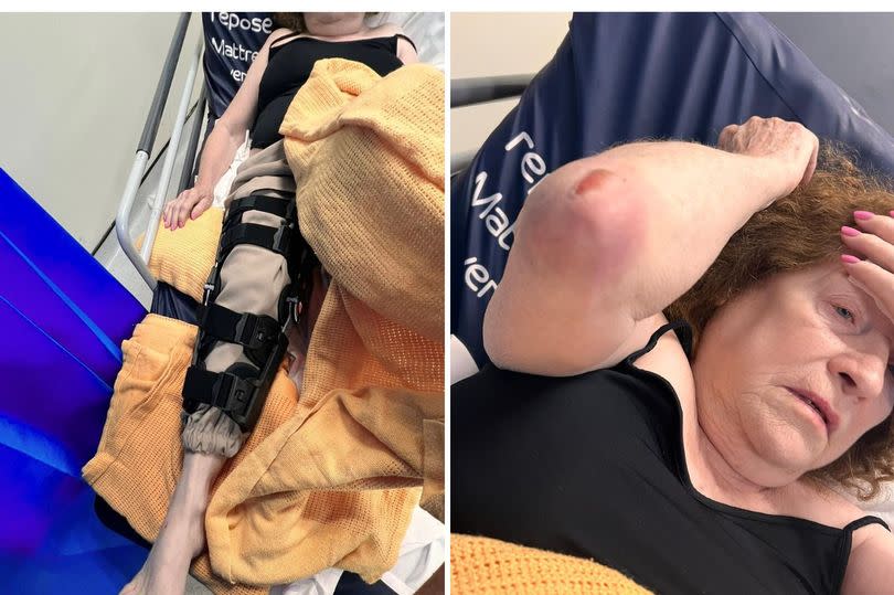 Dorothy McIntosh's knee was broken in the attack