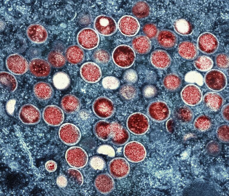 Esta imagen sin fecha proporcionada por el Instituto Nacional de Alergias y Enfermedades Infecciosas muestra una micrografía electrónica de transmisión coloreada de partículas de viruela simica (rojas) encontradas dentro de una célula infectada (azul), cultivadas en el laboratorio que fueron capturadas y mejoradas con color en el Centro de Investigación Integrada del NIAID