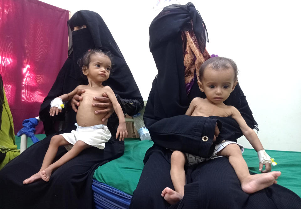 FILE - Women hold their malnourished children at Hays Rural Hospital in Hodeida, Yemen, Oct. 11, 2022. In many Middle Eastern and African nations, climatic shocks killed hundreds and displaced thousands every year, causing worsening food shortages. With limited resources, they also are among the world’s poorest and most vulnerable to climate change impacts. (AP Photo/Hussam Al-Bakry)