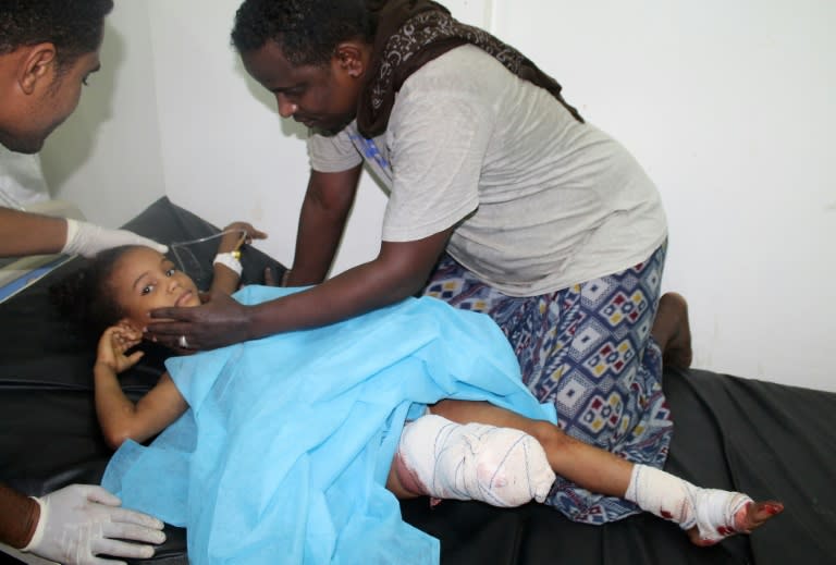 A badly wounded Yemeni girl lies on a hospital bed following a rocket attack by Huthi Shiite rebels and their allies in Aden on July 1, 2015