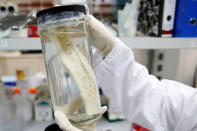 A researcher holds a vial containing a lab-grown, semi-liquid bone graft at the laboratory of Israeli biotech firm Bonus Biogroup in Haifa, Israel December 4, 2016. REUTERS/Baz Ratner