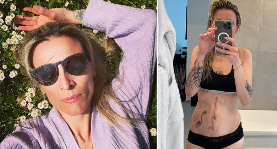 Woman laying in grass with sunglasses (left) Woman taking selfie with stomach scar (right)