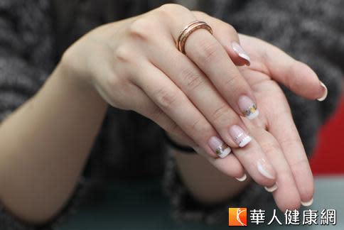 中醫師指出，從指甲的顏色、狀態確實可看出健康端倪。（攝影／黃志文）