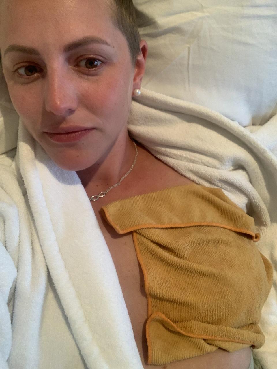 Robyn Goldman, who advocated for her own health while showing symptoms and was diagnosed with breast cancer, lies in a bed. (Photo provided by Robyn Goldman) 