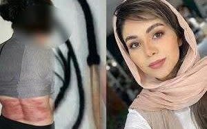 Roya Heshmati received 74 lashes in Iran for not wearing a religious veil